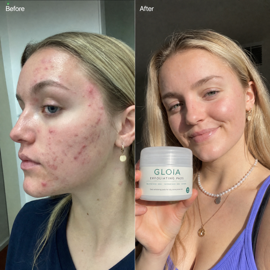 — Ava R., verified customer