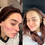 Ava